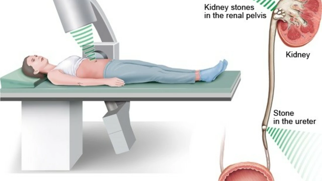 Nebivolol for Postural Hypotension: A Potential Treatment Option