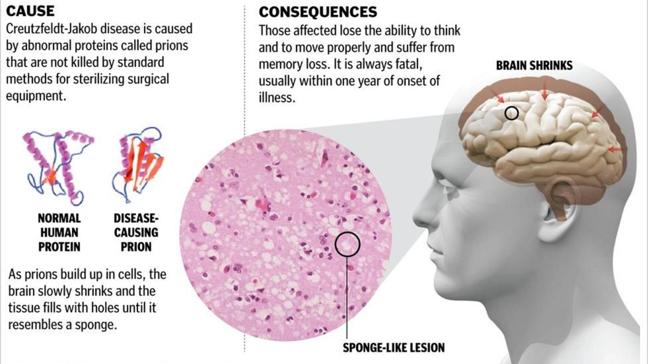 The Potential Side Effects of Hodgkin's Disease Treatments